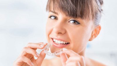 Clear aligners