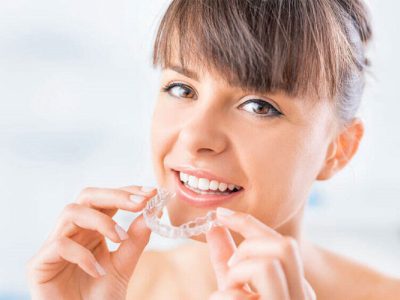 Clear aligners