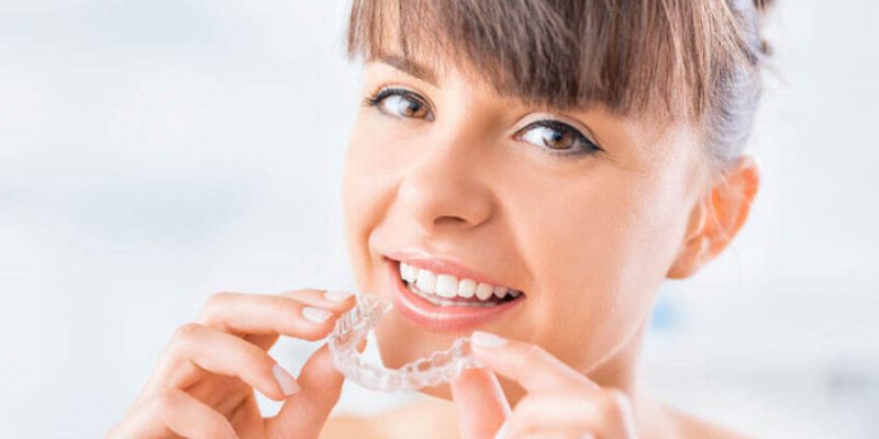 Clear aligners