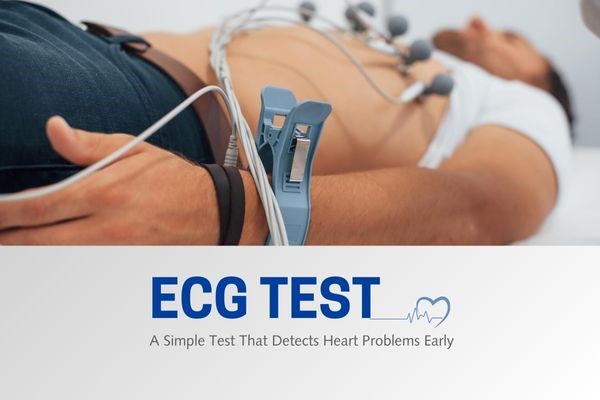 ECG Test